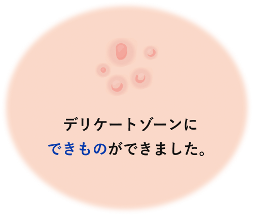 デリケートゾーンにできものができました。